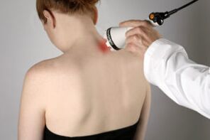 Terapia laser