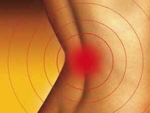 Dolore nella parte bassa della schiena con osteocondosi