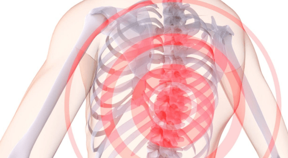 dolore alla colonna vertebrale con osteocondrosi toracica