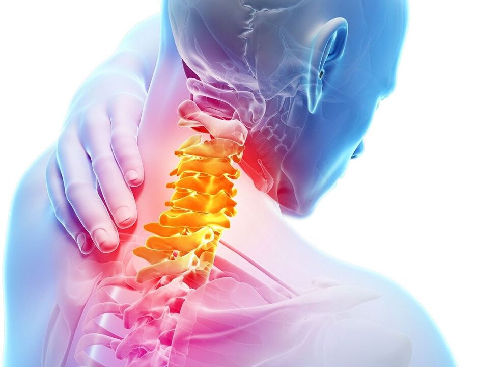 osteocondrosi del rachide cervicale